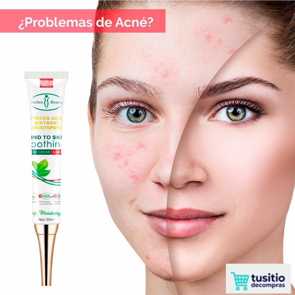 CREMA REPARADORA, HIDRATANTE ANTI ACNE